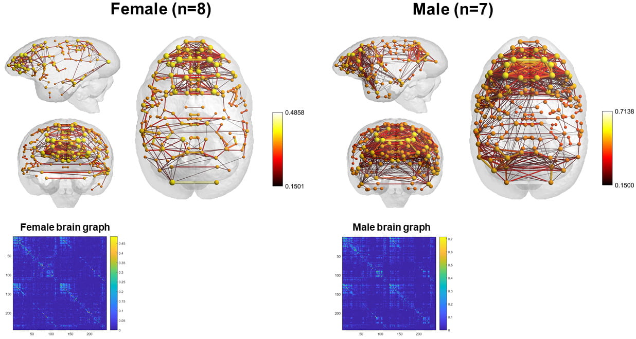 Visual of a female brain in comparison to a male brain