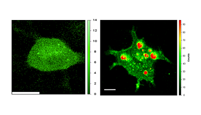 Image of a normal cell (left) and a cell under stress (right) showing the formation of stress granules  alt