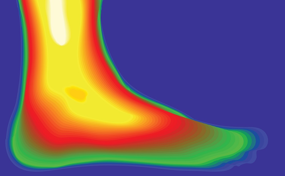 Thermal image of a foot