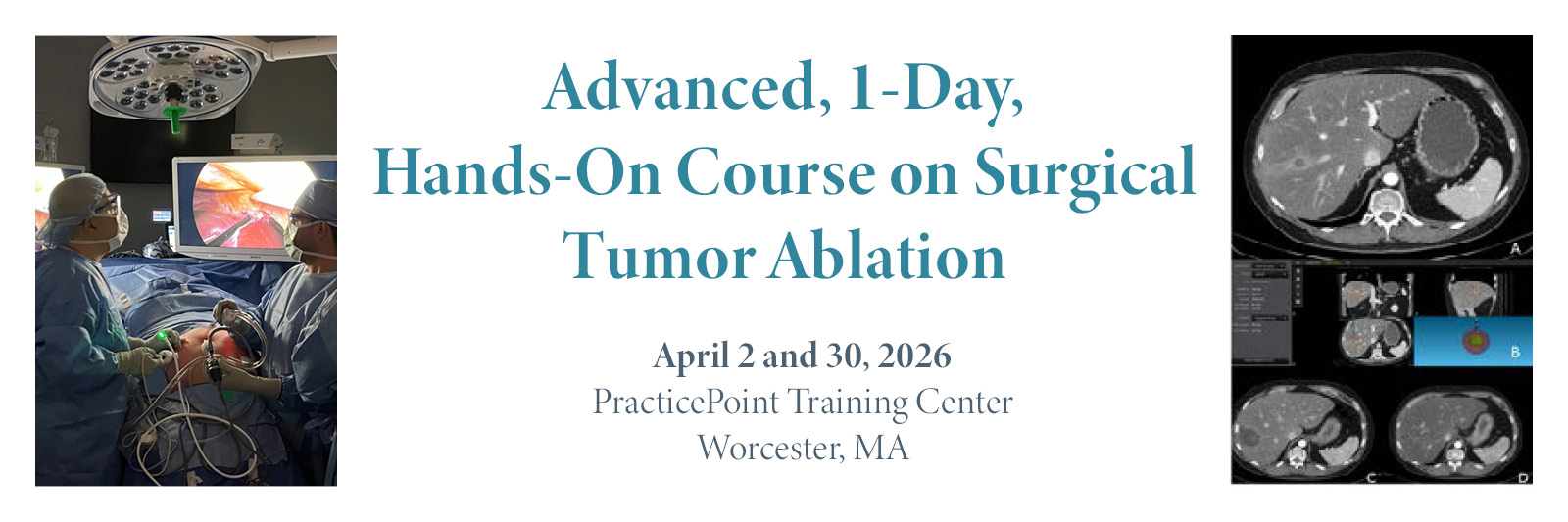 Banner with the text "Advanced, 1-Day, Hands-On Course on Surgical Tumor Ablation, April 2 and 30, 2026, PracticePoint Training Center, Worcester, MA" and two images, one pf two gowned surgeons performing laparoscopic surgery and one of an MRI cross section of a liver