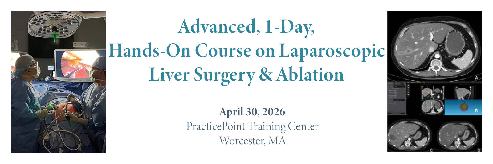 picture of two surgeons performing laparoscopic surgery while looking at a screen, picture of an MRI scan of a liver, large banner saying advanced 1-day hands on course on laparoscopic liver surgery and ablation, April 30, 2026, PracticePoint Training Center, Worcester, MA