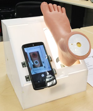A model foot is used to test a box that patients with advanced diabetes can use to monitor their foot ulcers with a smartphone and the Sugar app.