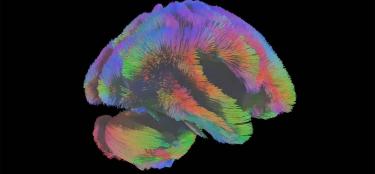 Colorful Illustration of a brain